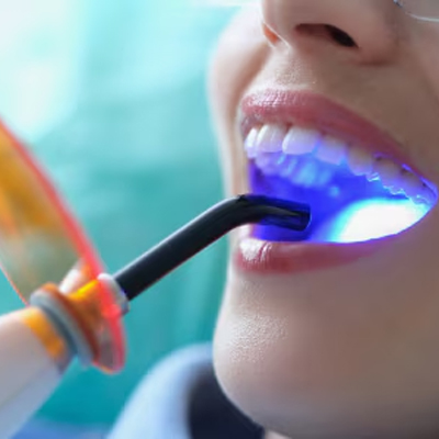 LED Curing Lights for Dental Professionals